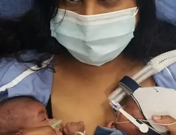 Anak Kembar Ini Dianugerahi Bayi Paling Prematur di Dunia